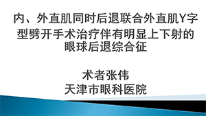内、外直肌同时后退联合外直肌Y字形劈开手术治疗伴有明显上下射的眼球后退综合征