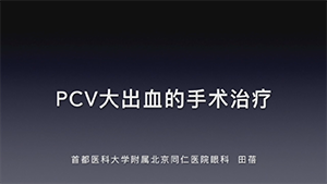 PCV大出血的手术治疗