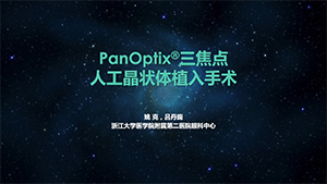 三焦点人工晶状体植入术