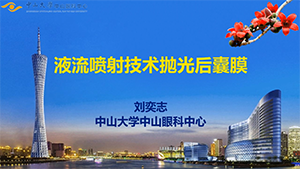 fluid-jet 技术抛光后囊膜