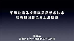 玻璃体视网膜手术切除视网膜色素上皮腺瘤