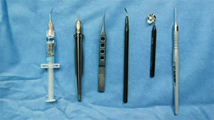 Kahook Dual Blade内路小梁切除术